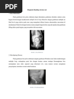 tort oyoqda chuqur tomoq