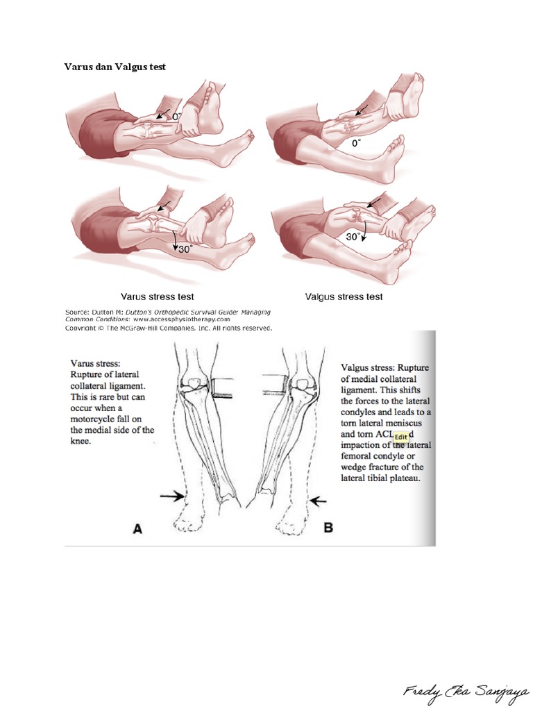 Uji Varus dan Valgus pada Lutut | PDF | Kajian Bahasa Asing | Kesehatan ...