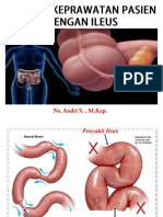 Askep Ileus