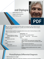 Ptosis and Diplopia: A Case of Ocular Myasthenia Gravis