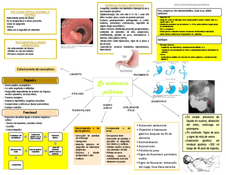Estenosis Pilórica: Diagnóstico y Tratamiento | PDF | Estómago | Vómitos