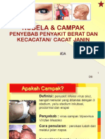 Campak Rubella Utk Awam