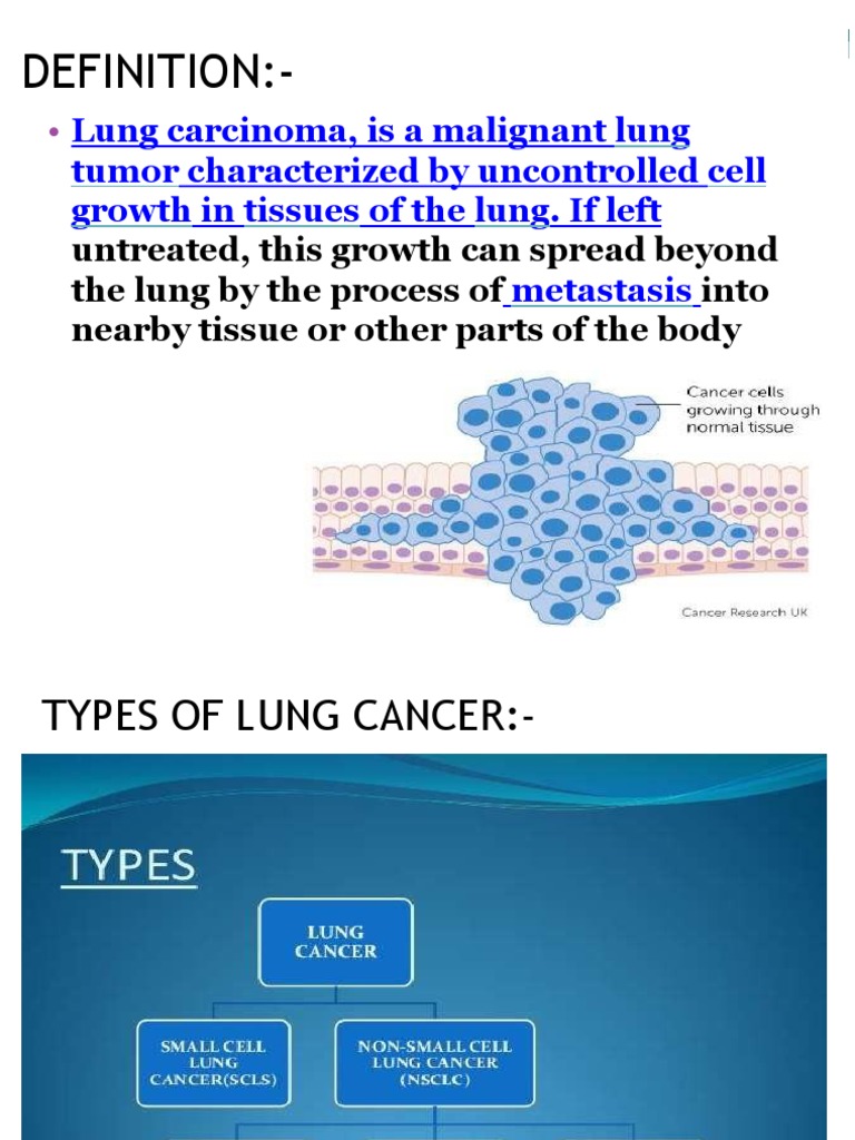 Lungcancerppt 161125132729 | PDF | Lung Cancer | Chemotherapy