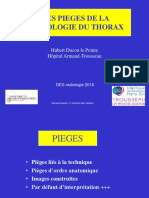 HDLP DES Les Pieges de La Radiologie Du Thoraxcomp