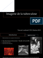 Tuberculose CI 2012FILEminimizer