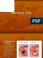 bronquitis.ppt