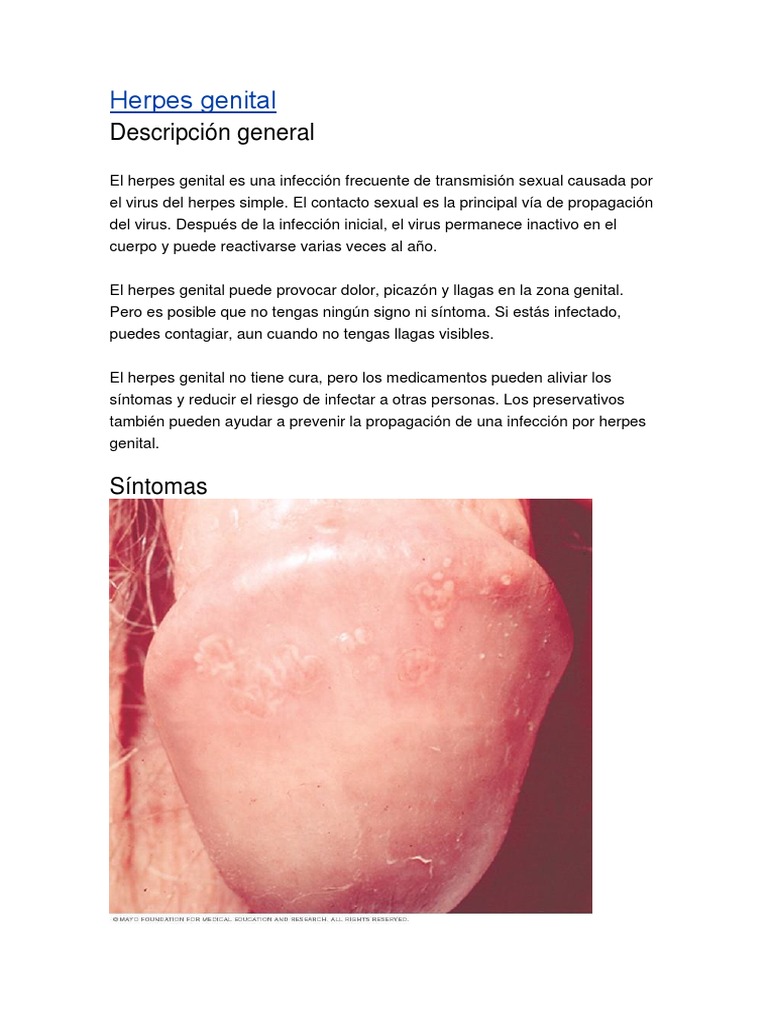 Herpes Genital | PDF | Herpes Simple | Infección transmitida sexualmente, image size:768x1024
