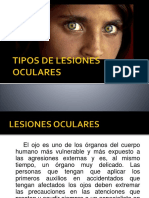 Tipos de Lesiones Oculares