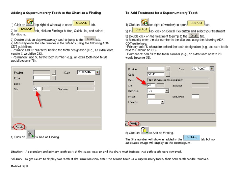 Adding Supernumerary Tooth in Chart | PDF