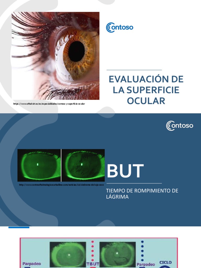 Evaluacion Superficie Ocular Especialidades Medicas Enfermedades Y Trastornos