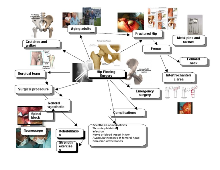 Hip Pinning Mind Map | PDF