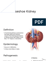 Horseshoe Kidney