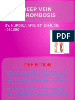 Deep Vein Thrombosis