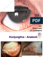 Konjungtivitis Fliktenularis