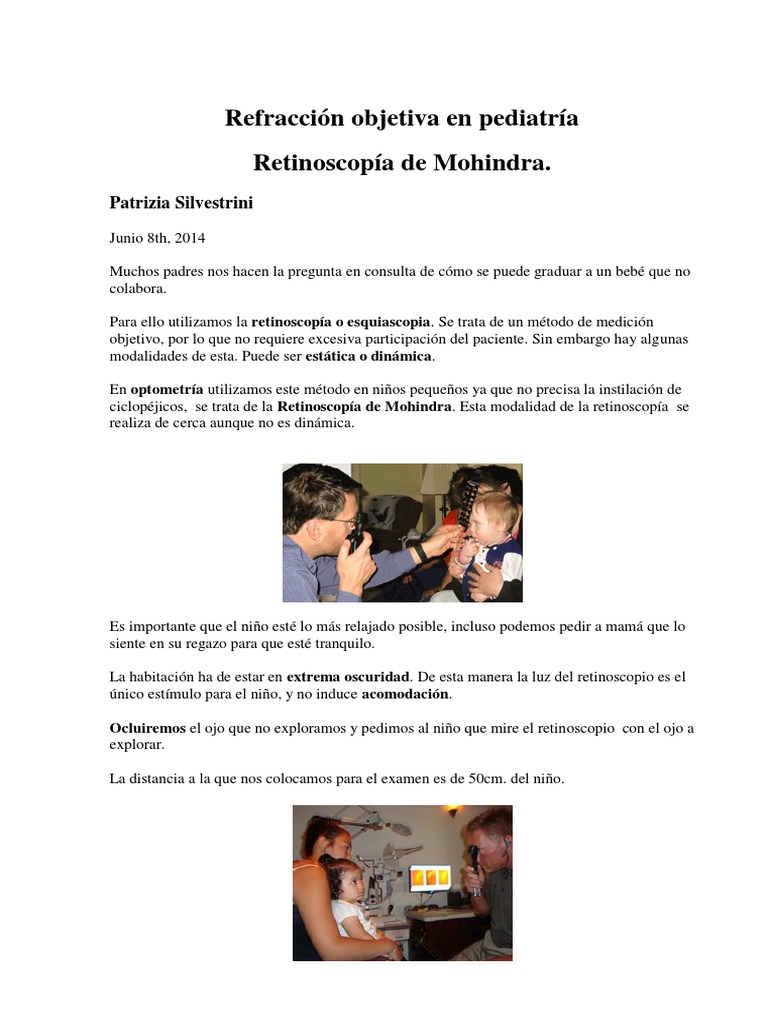 Retinoscopia de Mohindra PDF Ojo humano Optometría