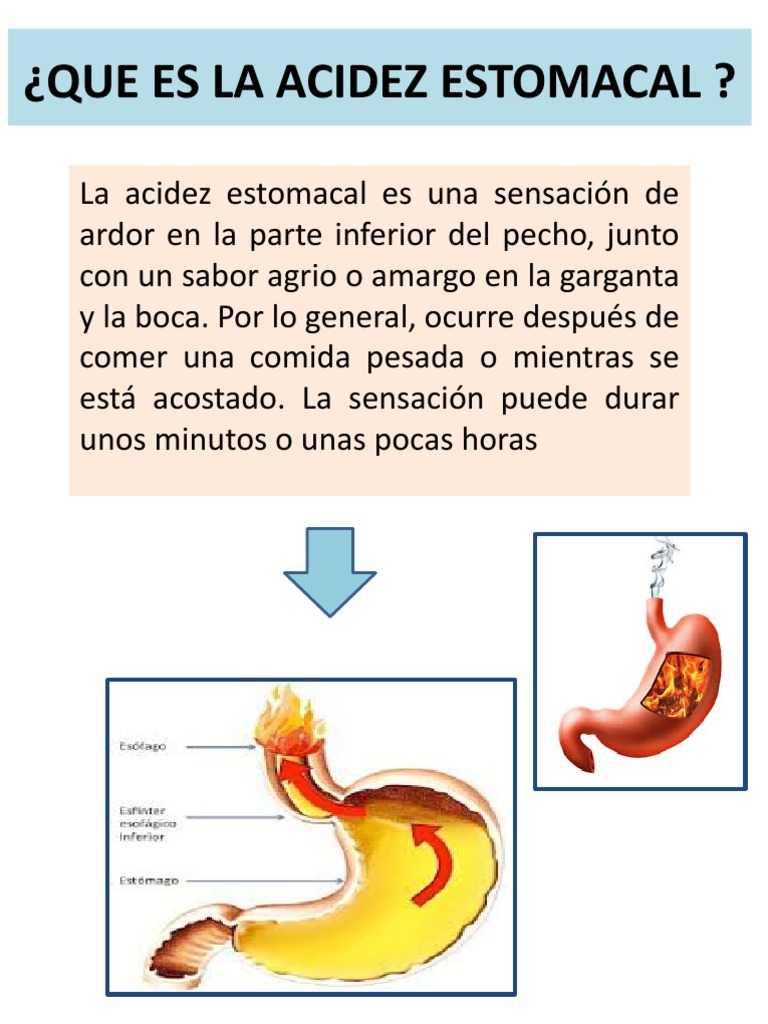 Cartelera Acidez Estomacal | PDF | Acidez | Estómago