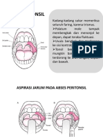 Abses Leher Dalam2