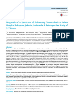 90757-90757Research Article Diagnosis of a Spectrum of Pulmonary Tuberculosis at Islam Hospital Sukapura, Jakarta, Indonesia- A Retrospective Study of 317 Cases