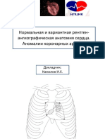 Анатомия коронарных артерий