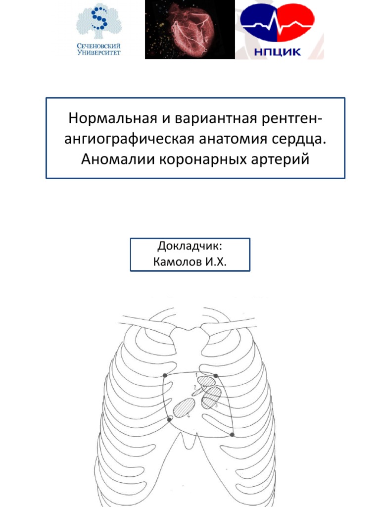 Анатомия Коронарных Артерий | PDF