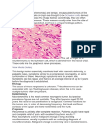 Neurilemmomas (Schwannomas): Symptoms, Diagnosis and Treatment of Benign Nerve Sheath Tumors