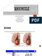 Varicocele