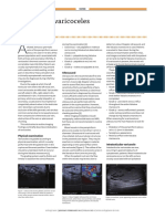 Imaging of Varicoceles: Ultrasound