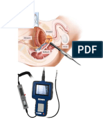 ENDOSCOPIO