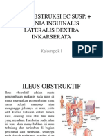 Ileus Obstruktif