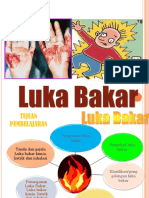Luka Bakar by Desi