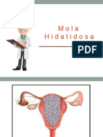 Mola Hidatidosa