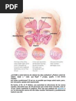 Sinusitis Sintomas