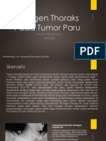 Rontgen Thoraks Pada Tumor Paru