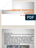 Prosedur Copping Logam Dr. Ayoeb Cekelee