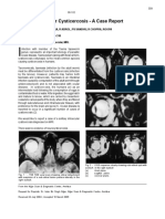 MRI in Intraocular Cysticercosis - A Case Report PDF