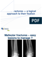 Ankle Fractures - A Logical Approach To Their Fixation