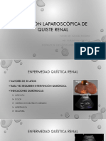 Ablación Laparoscópica de Quiste Renal