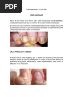 Anatomía de La Uña y Sus Partes | PDF | Clavo (anatomía) | Sistema ...