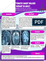 Case Report: Asymptomatic Dandy Walker Variant in Adult