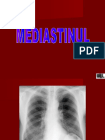 pulmonar mediastin