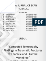 CT Thoracal Fix