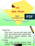 Oral Trush
