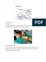 Lokasi Vena Pemasangan Infus