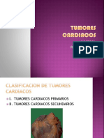 Tumores Cardiacos