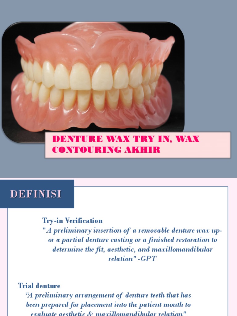 Denture Try in | PDF