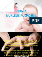 Hernia Nukleus Pulposus