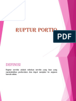 PP Rupture Porsio