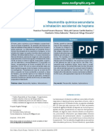 caso de neumonitis quimica.pdf