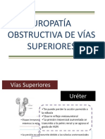Uropatia Obstructiva Vias Superiores