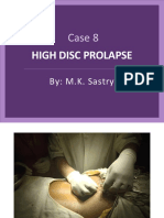 High Disc Prolapse - Case 8